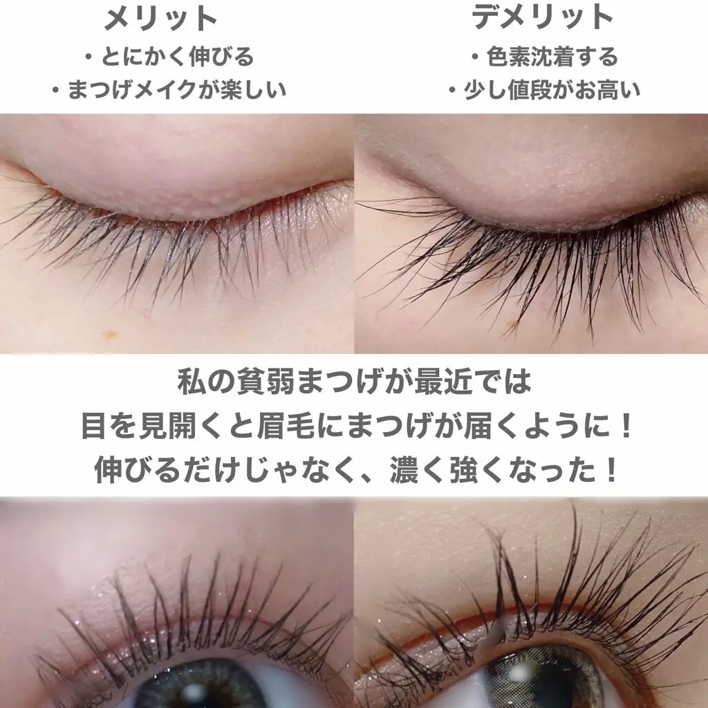 効果検証】エマーキット（EMAKED）は効果ない？利用者の口コミや評判を 